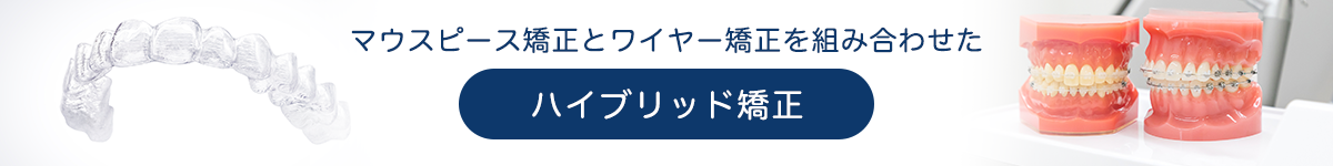 30分間の無料相談