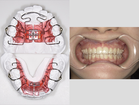 丈夫で綺麗な歯は、お子様への最高のプレゼント