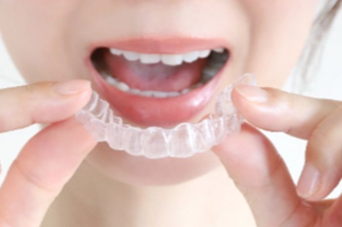 マウスピース矯正への移行が可能